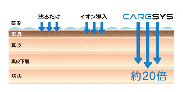 柏市でケアシス（クライオエレクトロポレーション）なら柏駅前